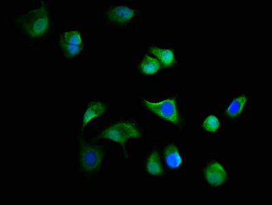 Immunofluorescence staining of MCF-7 cells with C19orf12 Antibody at 1:166, counter-stained with DAPI. The cells were fixed in 4% formaldehyde, permeabilized using 0.2% Triton X-100 and blocked in 10% normal Goat Serum. The cells were then incubated with the antibody overnight at 4°C. The secondary antibody was Alexa Fluor 488-congugated AffiniPure Goat Anti-Rabbit IgG(H+L).