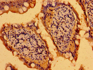 Immunohistochemistry of paraffin-embedded human small intestine tissue using the antibody at dilution of 1:100