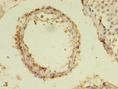 Immunohistochemistry of paraffin-embedded human testis tissue using C19orf47 Antibody at dilution of 1:100
