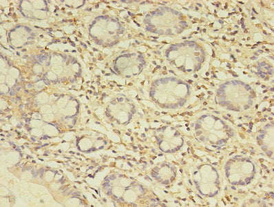 Immunohistochemistry of paraffin-embedded human small intestine tissue using C19orf47 Antibody at dilution of 1:100
