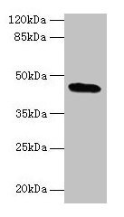 Western blot  | All lanes: C19orf47 antibody at 10µg/ml + Mouse muscle tissue  | Secondary  | Goat polyclonal to rabbit IgG at 1/10000 dilution  | Predicted band size: 45, 38, 30 kDa  | Observed band size: 45 kDa