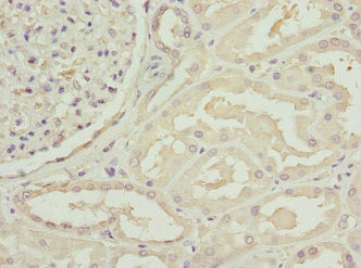 Immunohistochemistry of paraffin-embedded human kidney tissue using C1GALT1C1 Antibody at dilution of 1:100