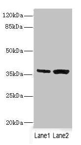 Western blot | All lanes: C1GALT1C1 antibody at 3.97μg/ml | Lane 1: Mouse gonadal tissue | Lane 2: Mouse liver tissue | Secondary | Goat polyclonal to rabbit IgG at 1/10000 dilution | Predicted band size: 36 kDa | Observed band size: 36 kDa