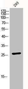Western Blot analysis of 293 cells using p27 Polyclonal AntibodyRabbit anti-Human CDKN1B Polyclonal Antibody