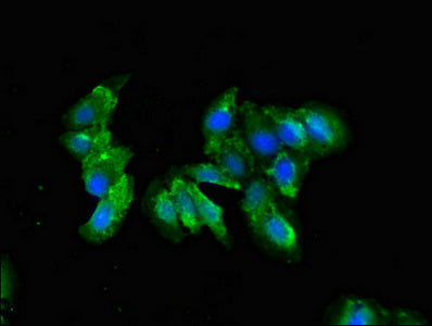 Immunofluorescent analysis of Hela cells using C1QA Antibody at dilution of 1:100 and Alexa Fluor 488-congugated AffiniPure Goat Anti-Rabbit IgG(H+L)
