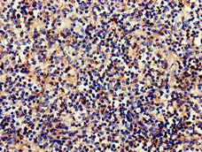 Immunohistochemistry of paraffin-embedded human spleen tissue using the antibody at dilution of 1:100