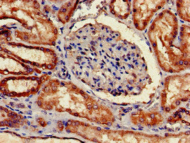 Immunohistochemistry of paraffin-embedded human kidney tissue using C1QA Antibody at dilution of 1:100