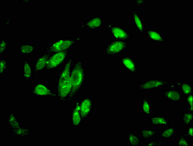 Immunofluorescent analysis of Hela cells using C1R Antibody at dilution of 1:100 and Alexa Fluor 488-congugated AffiniPure Goat Anti-Rabbit IgG(H+L)
