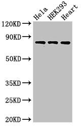 Western Blot | Positive WB detected in: Hela whole cell lysate, HEK293 whole cell lysate, Rat heart tissue | All lanes: C1R antibody at 3μg/ml | Secondary | Goat polyclonal to rabbit IgG at 1/50000 dilution | Predicted band size: 81 kDa | Observed band size: 81 kDa