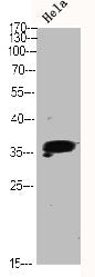 Western Blot analysis of HELA using p38 Polyclonal Antibody.