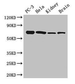 Western Blot  | Positive WB detected in: PC-3 whole cell lysate, Hela whole cell lysate, Mouse kidney tissue, Mouse brain tissue  | All lanes: GPI antibody at 2.7µg/ml  | Secondary  | Goat polyclonal to rabbit IgG at 1/50000 dilution  | Predicted band size: 64, 65 kDa  | Observed band size: 64 kDaRabbit anti-Human GPI Polyclonal Antibody