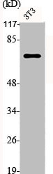 Western Blot analysis of NIH-3T3 cells using p73 Polyclonal AntibodyRabbit anti-Human TP73 Polyclonal Antibody