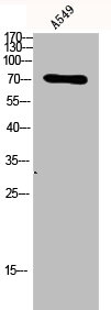 Western Blot analysis of A549 using p73 Polyclonal Antibody.Rabbit anti-Human TP73 Polyclonal Antibody