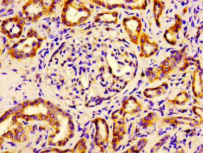 Immunohistochemistry of paraffin-embedded human kidney tissue using EIF4A2 Antibody at dilution of 1:100Rabbit anti-Human EIF4A2 Polyclonal Antibody