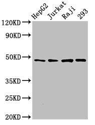 Western Blot  | Positive WB detected in: HepG2 whole cell lysate, Jurkat whole cell lysate, Raji whole cell lysate, 293 whole cell lysate  | All lanes: EIF4A2 antibody at 3µg/ml  | Secondary  | Goat polyclonal to rabbit IgG at 1/50000 dilution  | Predicted band size: 47 kDa  | Observed band size: 47 kDaRabbit anti-Human EIF4A2 Polyclonal Antibody