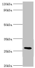 Western blot | All lanes: C4b-binding protein beta chain antibody at 6μg/ml + Mouse liver tissue | Secondary | Goat polyclonal to rabbit IgG at 1/10000 dilution | Predicted band size: 28 kDa | Observed band size: 28 kDa