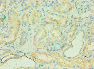 Immunohistochemistry of paraffin-embedded human kidney tissue using C4BPB Antibody at dilution of 1:100