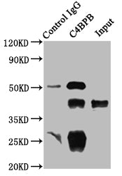 Immunoprecipitating C4BPB in HepG2 whole cell lysate | Lane 1: Rabbit control IgG instead of C4BPB Antibody in HepG2 whole cell lysate. | For western blotting, a HRP-conjugated Protein G antibody was used as the secondary antibody (1/2000) | Lane 2: C4BPB Antibody (8μg) + HepG2 whole cell lysate (500μg) | Lane 3: HepG2 whole cell lysate (10μg)