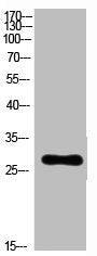 Western Blot analysis of customer&Rabbit anti-Human RPL7 Polyclonal Antibody