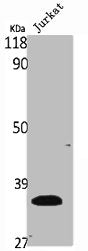 Western Blot analysis of Jurkat cells using Ribosomal Protein S6 Polyclonal AntibodyRabbit anti-Human RPS6 Polyclonal Antibody