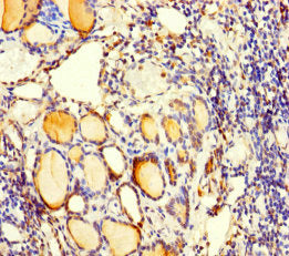 Immunohistochemistry of paraffin-embedded human thyroid tissue using the antibody at dilution of 1:100