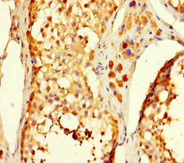 Immunohistochemistry of paraffin-embedded human testis tissue using C5orf51 Antibody at dilution of 1:100