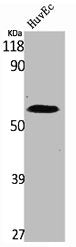 Western Blot analysis of HuvEc cells using SGK1 Polyclonal AntibodyRabbit anti-Human SGK1 Polyclonal Antibody