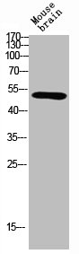 Western Blot analysis of mouse brain using SGK1 Polyclonal AntibodyRabbit anti-Human SGK1 Polyclonal Antibody