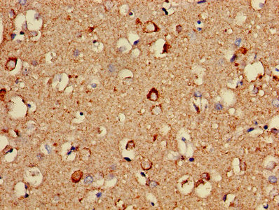 Immunohistochemistry of paraffin-embedded human brain tissue using COX5A Antibody at dilution of 1:100Rabbit anti-Human COX5A Polyclonal Antibody