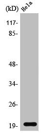 Western Blot analysis of Jurkat cells using SRp20 Polyclonal AntibodyRabbit anti-Human SRSF3 Polyclonal Antibody