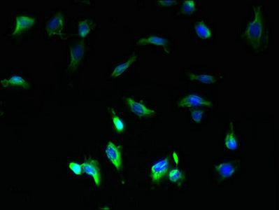 Immunofluorescent analysis of U251 cells using COA1 Antibody at dilution of 1:100 and Alexa Fluor 488-congugated AffiniPure Goat Anti-Rabbit IgG(H+L)Rabbit anti-Human COA1 Polyclonal Antibody