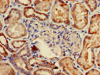 Immunohistochemistry of paraffin-embedded human kidney tissue using the antibody at dilution of 1:100Rabbit anti-Human COA1 Polyclonal Antibody