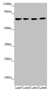 Western blot  | All lanes: C8B antibody at 1.28µg/ml  | Lane 1: Hela whole cell lysate  | Lane 2: Jurkat whole cell lysate  | Lane 3: Raji whole cell lysate  | Lane 4: Mouse liver tissue  | Secondary  | Goat polyclonal to rabbit IgG at 1/10000 dilution  | Predicted band size: 67 kDa  | Observed band size: 67 kDa