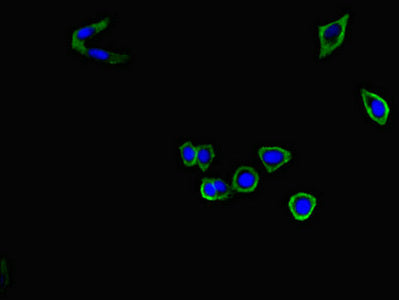 Immunofluorescent analysis of HepG2 cells using C9 Antibody at dilution of 1:100 and Alexa Fluor 488-congugated AffiniPure Goat Anti-Rabbit IgG(H+L)