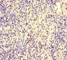 Immunohistochemistry of paraffin-embedded human spleen tissue using C9 Antibody at dilution of 1:100