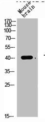 Western Blot analysis of mouse-brain cells using TGFβ1 Polyclonal AntibodyRabbit anti-Human TGFB1 Polyclonal Antibody