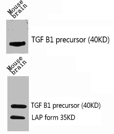 Western Blot analysis of mouse-brain using TGFβ1 Polyclonal Antibody.Rabbit anti-Human TGFB1 Polyclonal Antibody