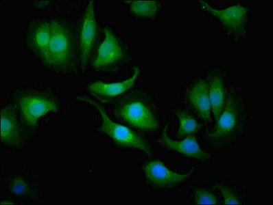 Immunofluorescent analysis of A549 cells using CA1 Antibody at dilution of 1:100 and Alexa Fluor 488-congugated AffiniPure Goat Anti-Rabbit IgG(H+L)