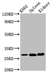 Western Blot  | Positive WB detected in: K562 whole cell lysate, Mouse spleen tissue, Mouse kidney tissue  | All lanes: CA1 antibody at 6.5µg/ml  | Secondary  | Goat polyclonal to rabbit IgG at 1/50000 dilution  | Predicted band size: 29 kDa  | Observed band size: 29 kDa
