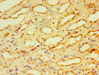 Immunohistochemistry of paraffin-embedded human kidney tissue using CA12 Antibody at dilution of 1:100