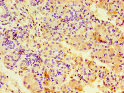 Immunohistochemistry of paraffin-embedded human pancreatic tissue using CA12 Antibody at dilution of 1:100