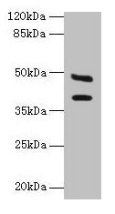 Western blot  | All lanes: CA12 antibody at 6µg/ml + Mouse kidney tissue  | Secondary  | Goat polyclonal to rabbit IgG at 1/10000 dilution  | Predicted band size: 40, 39 kDa  | Observed band size: 40, 48 kDa