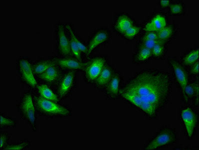 Immunofluorescent analysis of Hela cells using CA2 Antibody at dilution of 1:100 and Alexa Fluor 488-congugated AffiniPure Goat Anti-Rabbit IgG(H+L)