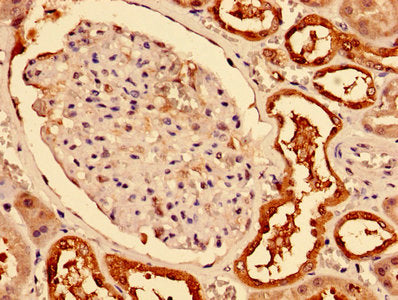 Immunohistochemistry of paraffin-embedded human kidney tissue using CA2 Antibody at dilution of 1:100