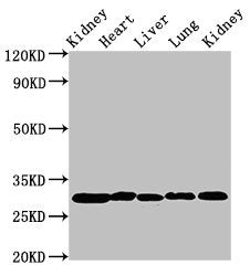Western Blot  | Positive WB detected in: Rat kidney tissue, Rat heart tissue, Rat liver tissue, Mouse lung tissue, Mouse kidney tissue  | All lanes: CA2 antibody at 2µg/ml  | Secondary  | Goat polyclonal to rabbit IgG at 1/50000 dilution  | Predicted band size: 30 kDa  | Observed band size: 30 kDa