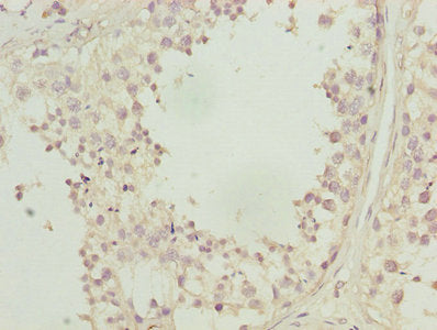 Immunohistochemistry of paraffin-embedded human testis tissue using CA3 Antibody at dilution of 1:100