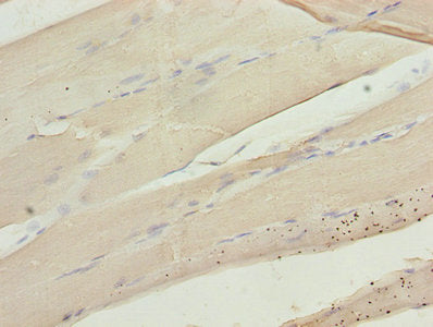Immunohistochemistry of paraffin-embedded human skeletal muscle tissue using CA3 Antibody at dilution of 1:100