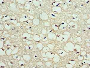 Immunohistochemistry of paraffin-embedded human brain tissue using CA8 Antibody at dilution of 1:100