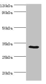 Western blot | All lanes: CA8 antibody at 8μg/ml + Mouse liver tissue | Secondary | Goat polyclonal to rabbit IgG at 1/10000 dilution | Predicted band size: 33 kDa | Observed band size: 33 kDa