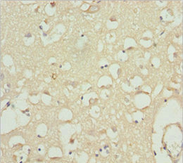 Immunohistochemistry of paraffin-embedded human brain tissue using CACNB1 Antibody at dilution of 1:100